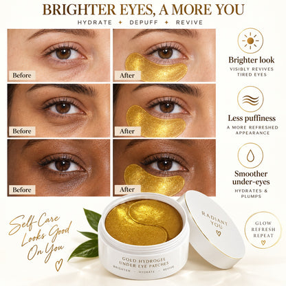Gold Collagen Hydrogel Eye Patches before and after under-eye brightening and smoothing results