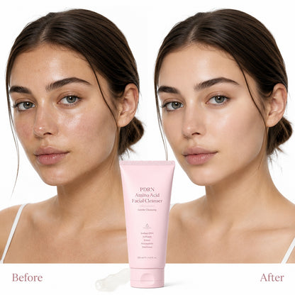 Before and after skincare model comparison with PDRN amino acid facial cleanser