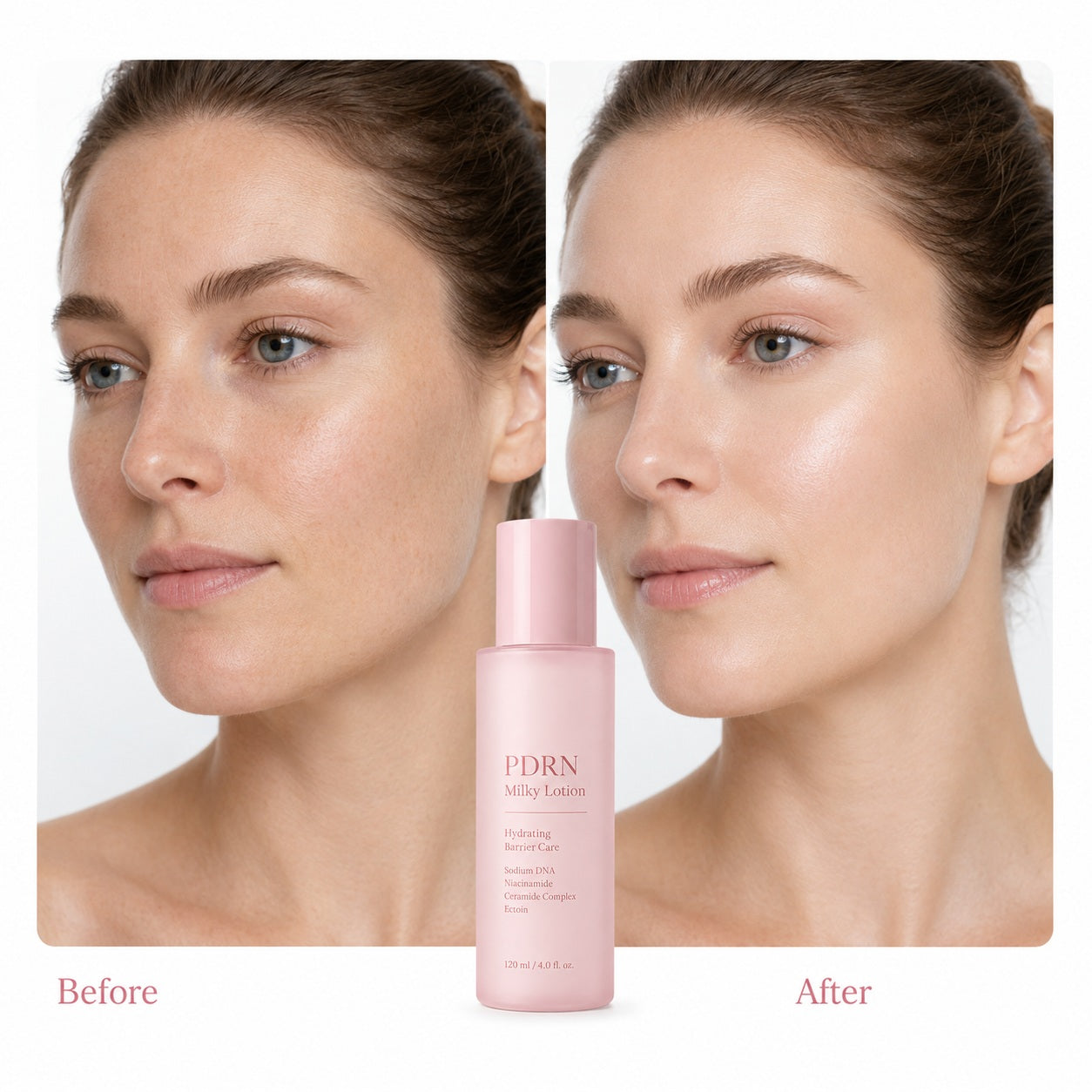 Before and after model comparison showing hydrated and smoother-looking skin with PDRN milky lotion