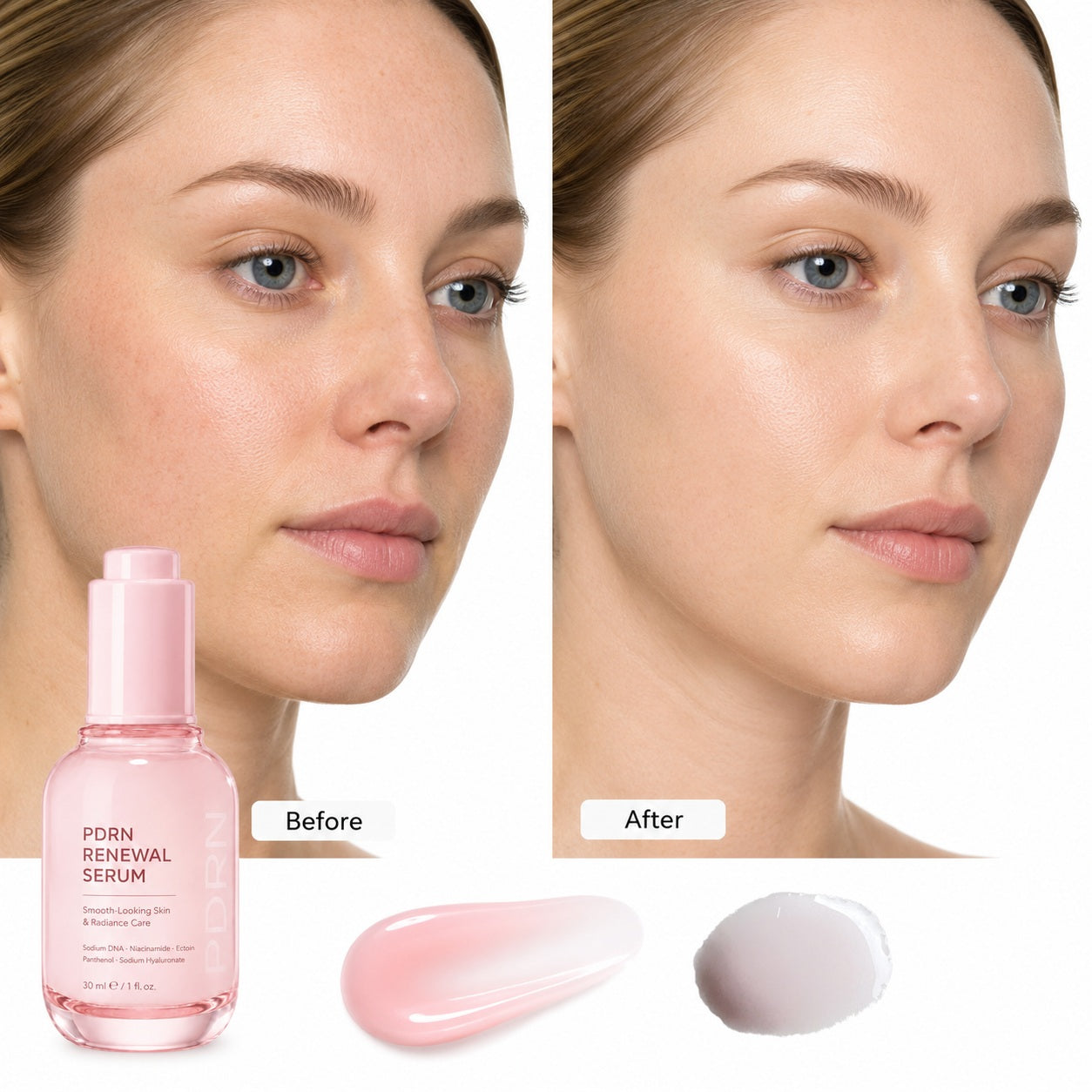 Illustrative before-and-after skin appearance comparison for PDRN Renewal Serum