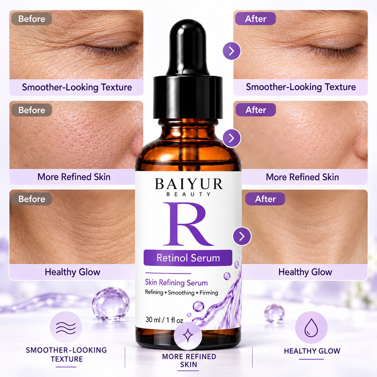 Illustrative skin comparison showing differences in fine lines, uneven texture and skin smoothness alongside Baiyur Beauty Retinol Serum.