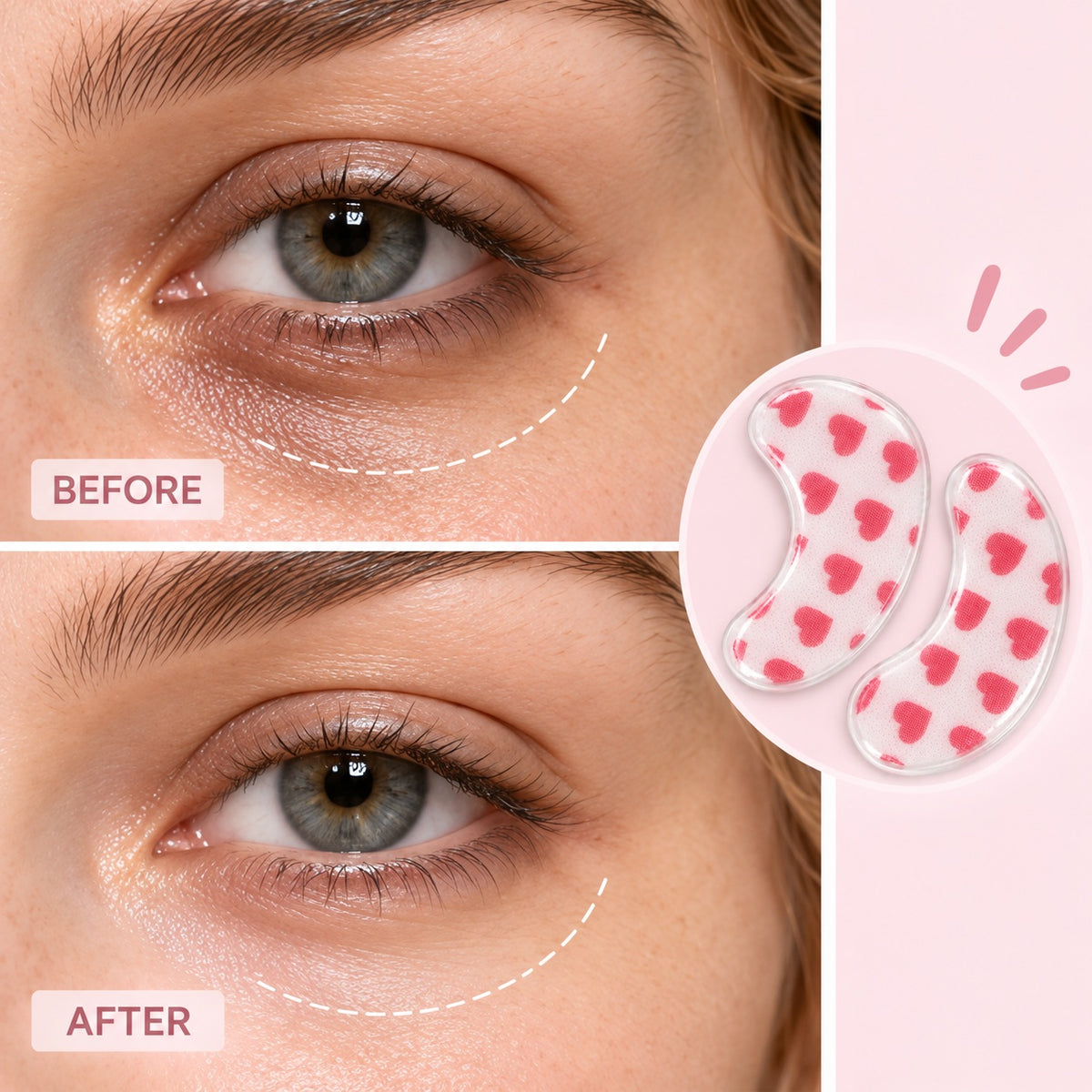 Sweet Heart custom printed hydrogel eye patches before and after under-eye care comparison
